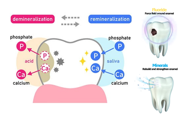 Effective Ways to Remineralize Teeth in 2025 and Enhance Your Smile