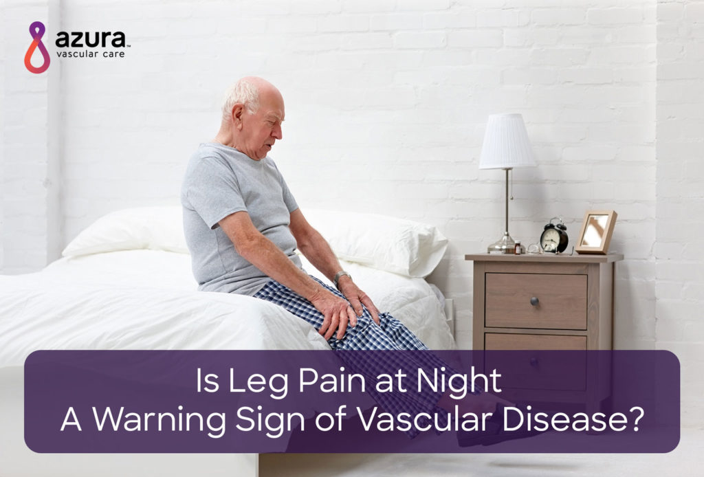 How to Effectively Relieve Severe Leg Pain at Night: Proven Tips for 2025