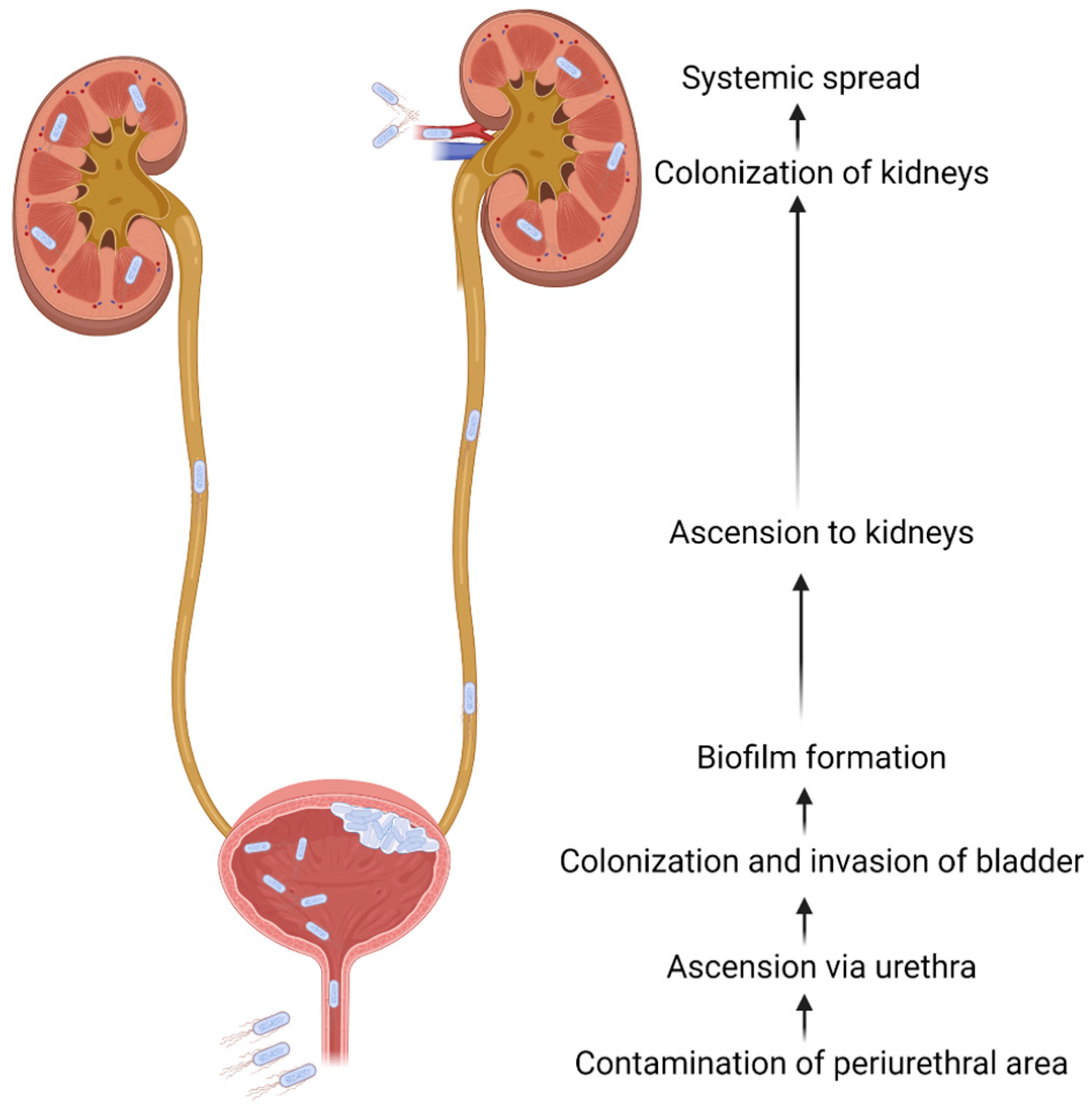 How to get rid of UTI Fast